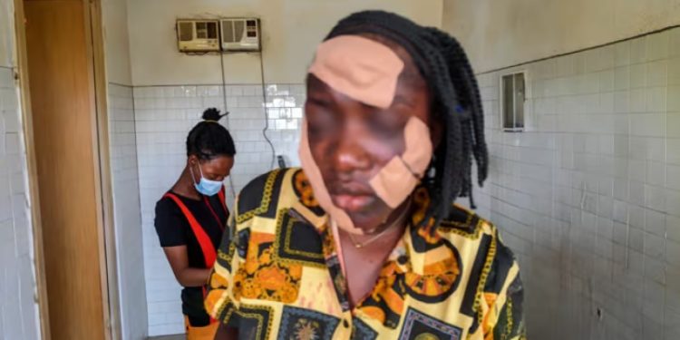 Teen Girl Scarred In Taraba Attack, Family Demands Justice